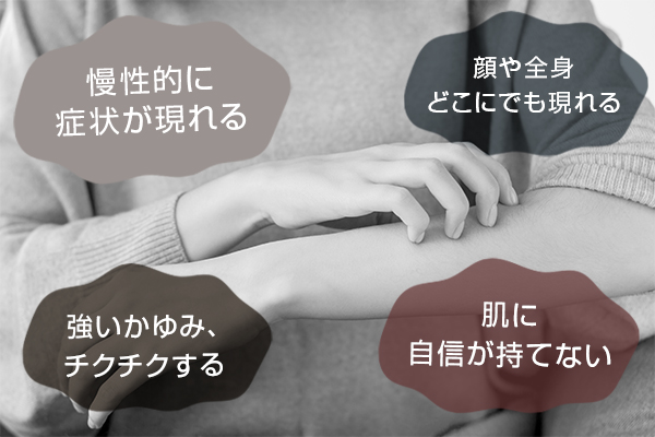 ✓慢性的に症状が現れる✓強いかゆみ、チクチクする✓顔や全身どこにでも現れる✓肌に自信が持てない