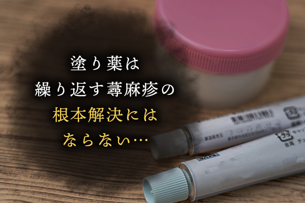塗り薬は繰り返す蕁麻疹の根本解決にはならない…